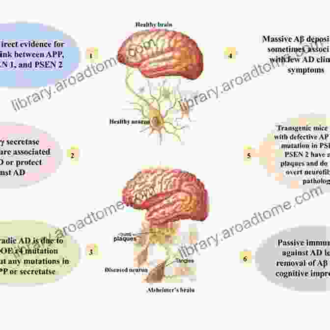 A Labyrinth Representing The Complexities Of Alzheimer's Disease Something On My Mind: Kate Jowell: A Battle With Alzheimer S