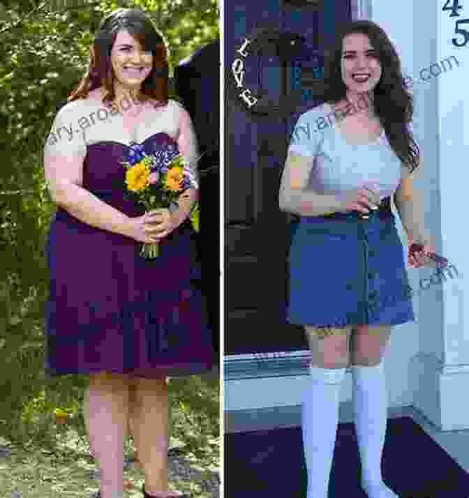 Person Before And After Weight Loss Journey Successful Weight Loss